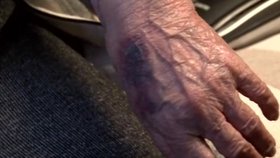 Třídenní boj o život! Stařeček (82) z Dejvic uvázl ve vaně. Pil vodu, aby přežil