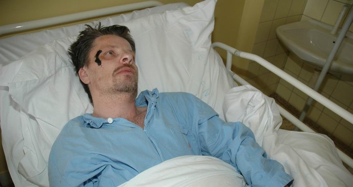 Luboš Pechman se v březnu 2008 v nemocnici rozplakal, když Blesku líčil jak mu lupič sebrali všechny peníze