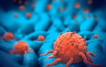 Nová metoda v léčbě rakoviny: Vyléčí nádor slinivky?