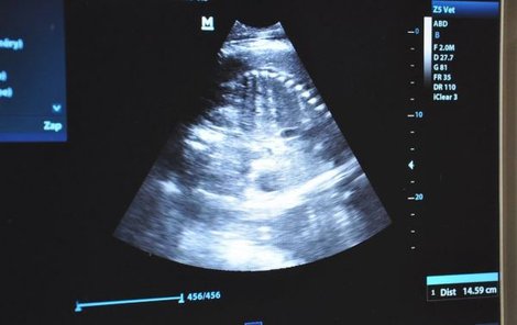 Těhotenský sloní ultrazvuk.