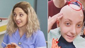 Anička Slováčková uprostřed chemoterapií: Holení hlavy žiletkou pro dobrou věc!