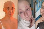 Anna Slováčková rok bojovala s rakovinou prsu