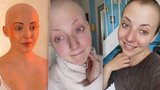 Anička Slováčková porazila rakovinu! Fotky, která mapují její boj se zákeřnou nemocí 