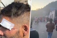 Desítky lidí se na Slovensku popraly kvůli jídlu: Mačety, pálky i lopaty!