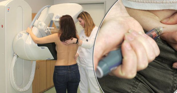 Čechy zabíjí rakovina a cukrovka. Lékaři hlásí dvojnásobný nárůst nemocných za 30 let