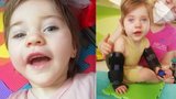 Sofinka (1) bojuje od narození s vážnými zdravotními problémy: Jednoho dne se postaví na nohy, věří její maminka