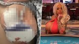 Bývalé pornohvězdě vyhnil implantát! Teď z nemocnice žebrá o peníze na další operaci