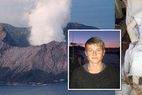 Šokující fotky znetvořeného mladíka (19): Výbuch sopky v dovolenkovém ráji mu spálil většinu těla!