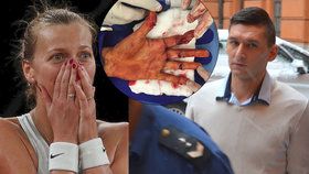 Drama u soudu v kauze Kvitová: Žondru prý poškodili při rekognici, tenistka při tom plakala