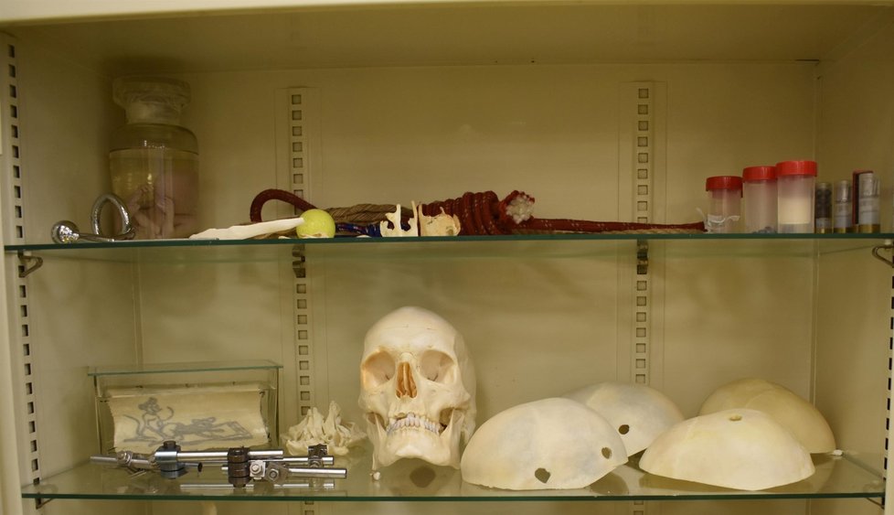 V „muzeu“ s artefakty, které zůstaly na pitevně, jsou i škrtidla či úlomky projektilů.