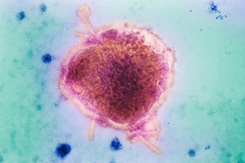 Takhle vypadá virus spalniček. Antibiotika proti němu nic nezmůžou.
