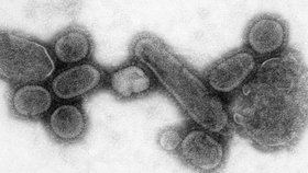 Viriony španělské chřipky pod elektronovým mikroskopem