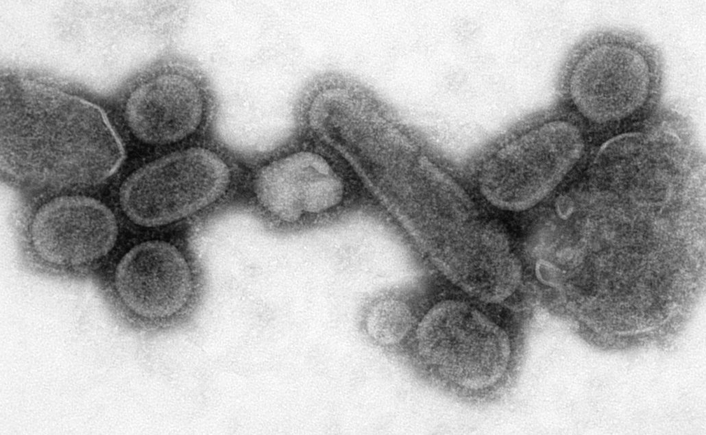 Virus španělské chřipky napadal i mladé a zdravé jedince.