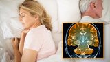 Rizikové „akční snění“: Křik a kopání ve spánku mohou značit vážnou nemoc