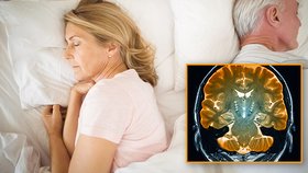 Parasomnie - nemoc, která se projevuje ve spánku může vést ke vzniku Parkinsonovy choroby (ilustrační foto)