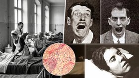 Tajemná spavá nemoc zabila asi milion lidí! Ti co přežili, zůstali uvěznění ve vlastním těle