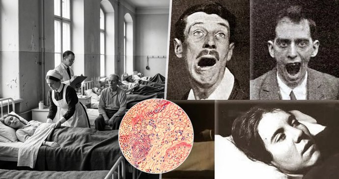 Tajemná spavá nemoc zabila asi milion lidí! Ti co přežili, zůstali uvěznění ve vlastním těle