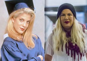 Tori Spelling děsila okolí oteklým obličejem.