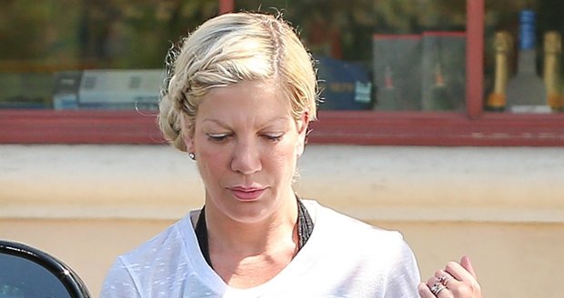 Tori Spelling ukázala popálenou ruku.