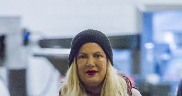 Tori Spelling děsila svým oteklým obličejem.