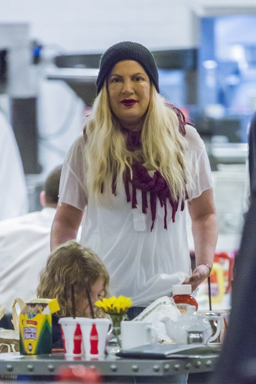 Tori Spelling děsila svým oteklým obličejem.