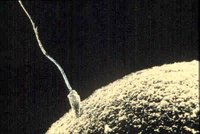 Sója snižuje počet spermií!