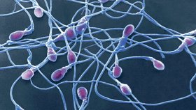 V USA se může spermiemi jednoho dárce uměle oplodnit neomezené množství žen