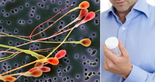 Spermageddon: Konec plodných mužů v roce 2040? Kvalitu spermií zhoršují plasty nebo i paracetamol