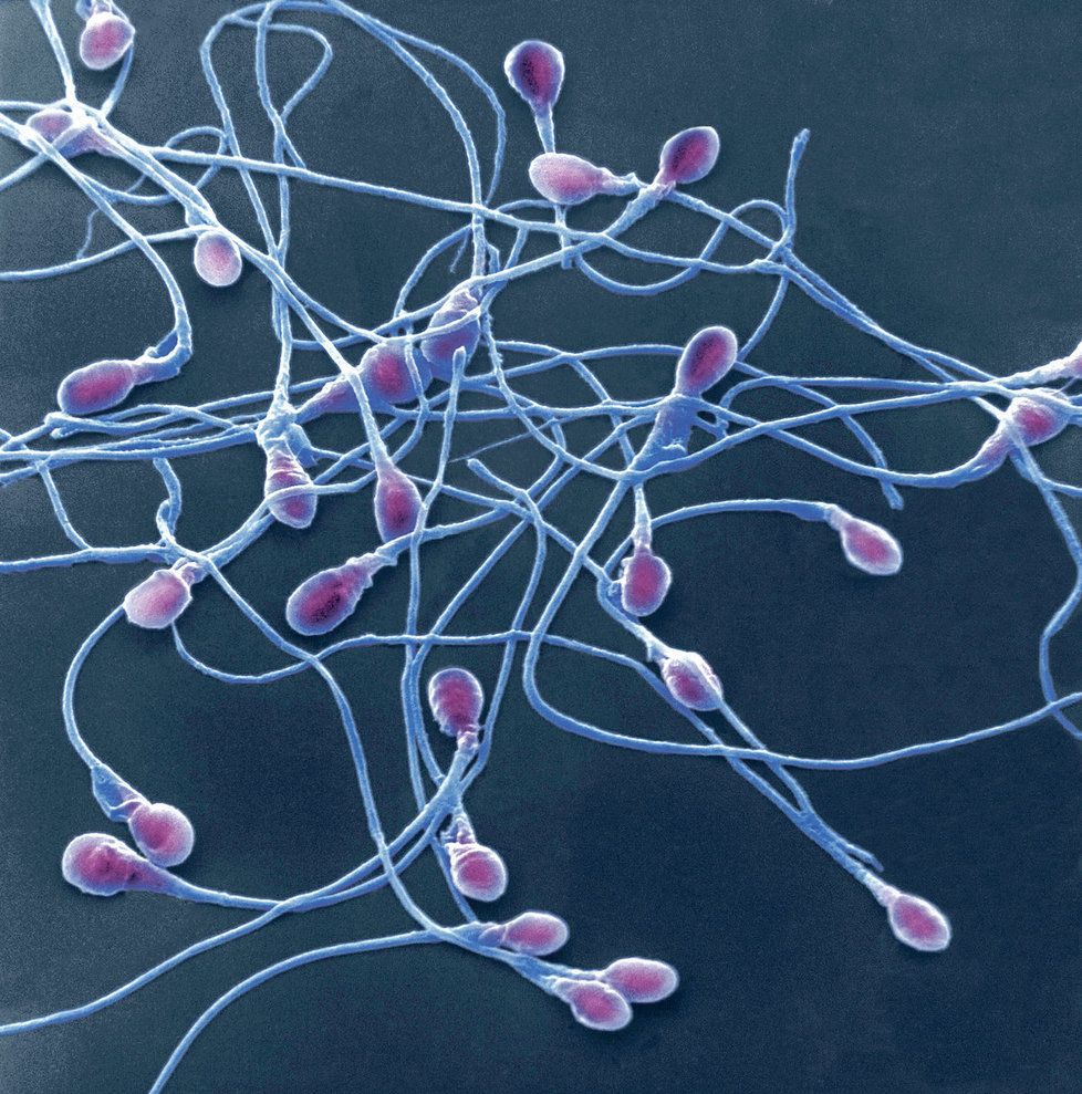 „Civilizované“ spermie chřadnou a my to nemůžeme ovlivnit, říká lékař.