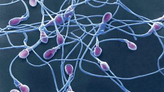 Objevy týdne: Plavající spermie vypadají jako mořské výtvory a lekce historie od Jana Zahradila