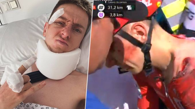 Rychlý návrat Pogačara po hrůzostrašném pádu? Může riskovat doživotní ochrnutí Rychlý návrat Pogačara po hrůzostrašném pádu? Může riskovat doživotní ochrnutí