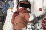 Pozitivní žena porodila miminko a zemřela: Dítě podle lékařů přežije.