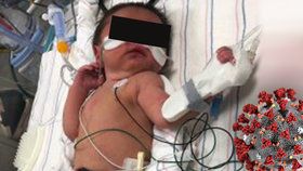 Pozitivní žena porodila miminko a zemřela: Dítě podle lékařů přežije.