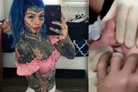 Milovnice tetování oslepla po šíleném zákroku: Oční bulvy si nechala nabarvit na modro