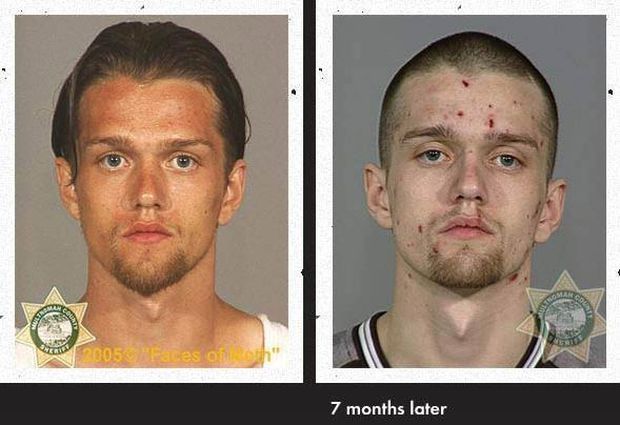 Efekty drogy Crystal Meth Efekty drogy Crystal Meth