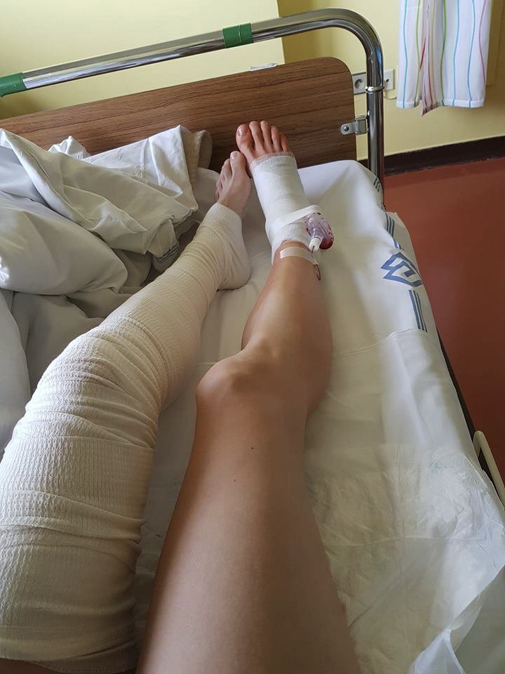 Denisa Rosolová musela plánovanou operaci nohy o týden odložit kvůli pádu na HME.