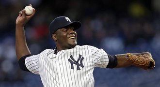 Konec zlozvyku. Baseballistům v New Yorku zakázali žvýkací tabák