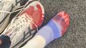 Při Londýnském maratonu skotské běžkyni Eilish McColganové explodoval prst
