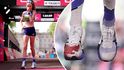 Při Londýnském maratonu skotské běžkyni Eilish McColganové explodoval prst