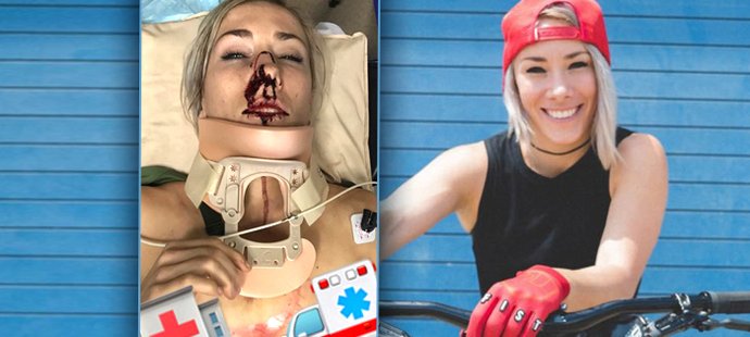 Bikerka Caroline Buchananová skončila po autonehodě s krvavými šrámy v obličeji
