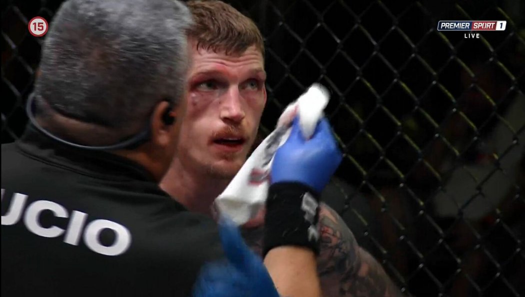 David Dvořák v UFC prohrál na body s Portugalcem Kapem