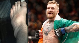 McGregorův zápas o další titul UFC musí odložit, soupeř si zlomil nohu