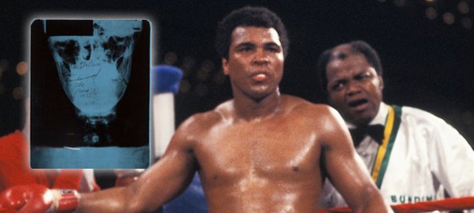 Rentgenový snímek zlomené čelisti Muhammada Aliho z roku 1973 má nového majitele