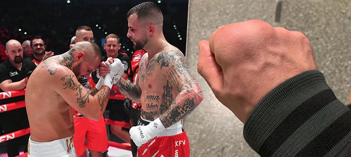 Otakar Petřina, alias Marpo, boxoval proti Rytmusovi s bolavou rukou, v noci po zápase musel k lékaři...