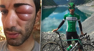 Cyklistu štípl hmyz a oteklo mu hrozivě oko. Proč si nemohl vzít léky?