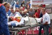 Zdeněk Štybar musel odjet do nemocnice, ošklivě upadl a vyrazil si zuby