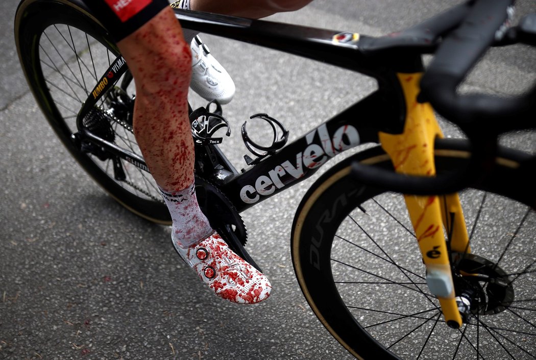 Hororový pohled na zkrvavenou nohu nizozemského cyklisty Stevena Kruijswijka