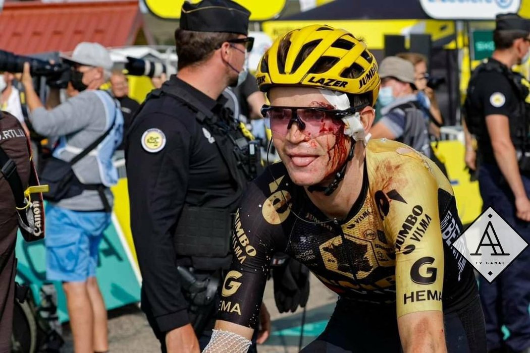 Sepp Kuss měl po pádu na Tour de France zkrvavený obličej