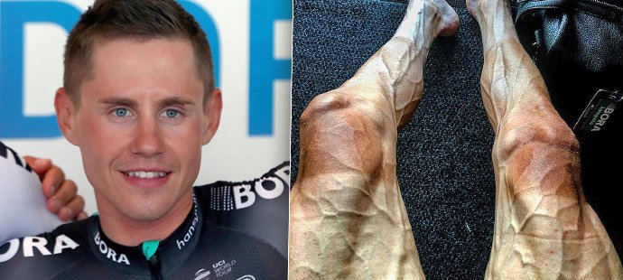 Tour de France bolí! Naběhnuté žíly a oteklé nohy ukázal také polský cyklista