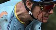 Jakob Fuglsang dojížděl první etapu Tour de France potrhaný s krvavým čůrkem ve tváři
